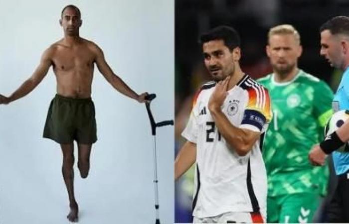 رياضة : لاعب فقد ساقه وراء إيقاف مباراة ألمانيا والدنمارك "حكاية مُرعبة"