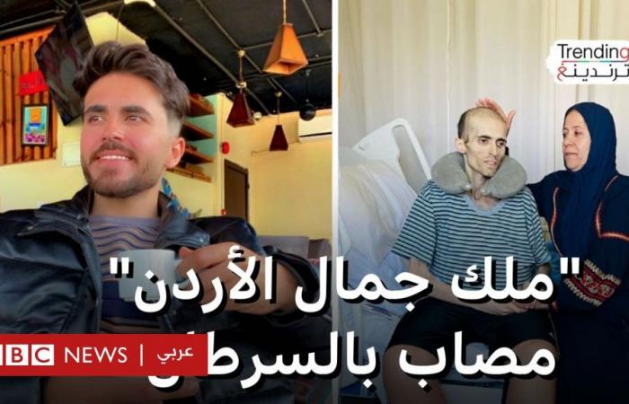 أخبار العالم : أيمن علي.. "ملك جمال الأردن" يشارك رحلة علاجه من مرض السرطان